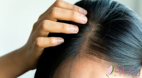 علاج تساقط الشعر من الصيدلية