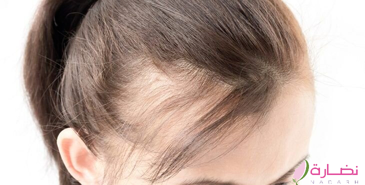 علاج تساقط الشعر من الصيدلية