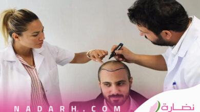 عيادات زراعة الشعر في الرياض