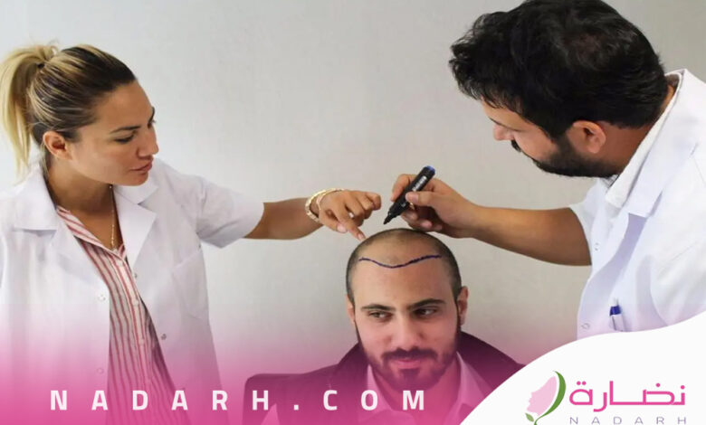 عيادات زراعة الشعر في الرياض